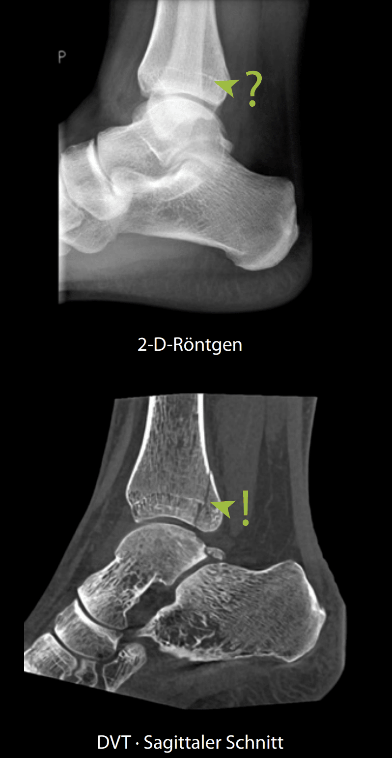 2dvs3d 1 | zoum.de | Bald Verfügbar! Digitale Volumentomographie (DVT)